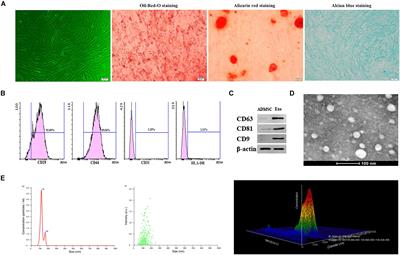 Exosomes Derived From Adipose-Derived Mesenchymal Stem Cells Ameliorate Radiation-Induced Brain Injury by Activating the SIRT1 Pathway